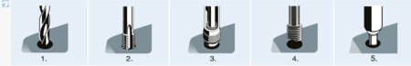 BN 910 AMECOIL® SR 帶導舌的螺紋護套 帶自由運行的螺紋